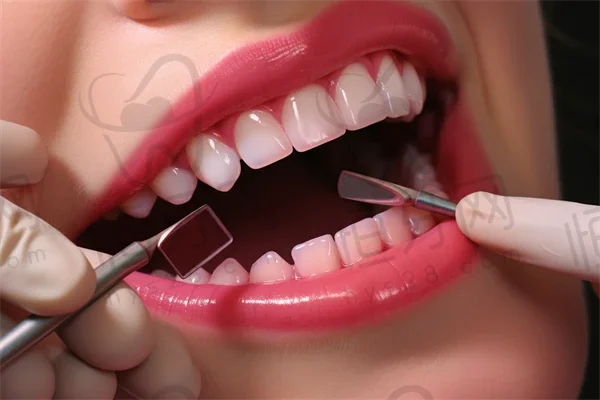 睢宁微笑口腔诊所:美学设计与性价比兼备