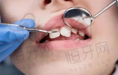 衡水牙博士口腔擅长什么项目：