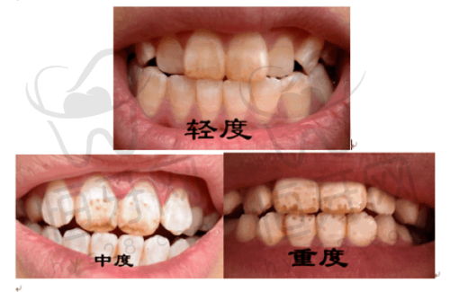 廊坊8020口腔门诊部口碑怎么样？