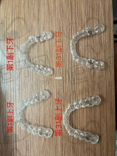 太原达美联合口腔门诊部价格表：