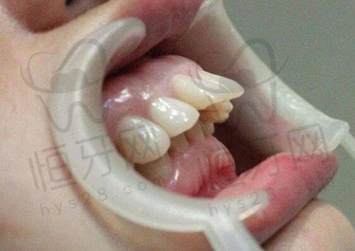 廊坊固安牙卫士口腔门诊部怎么预约挂号？