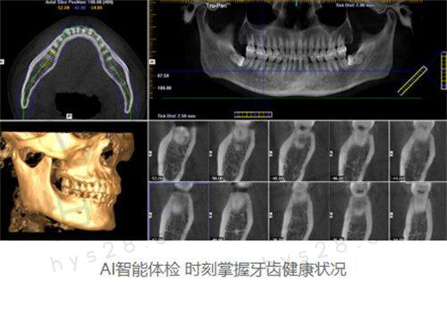 海口植之道口腔：高难度种植技术实力派选手