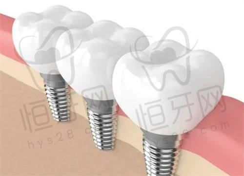 常德市第一人民医院口腔科：公办具有影响力，诊疗更规范