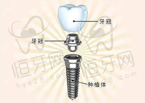 桂林口腔科哪个医院最好？这十家热门医院排名及特色全揭秘！