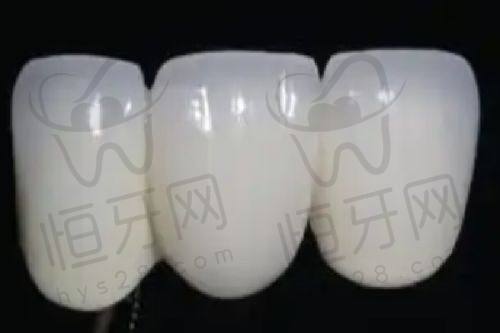 新诚口腔：预算有限者的优质选择