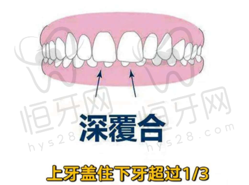 凤华口腔:进口品牌种植体、千元级体验