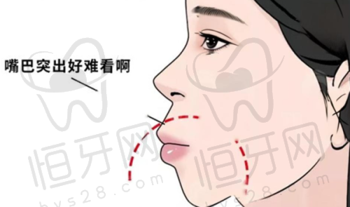大庆晨光口腔医院：数字化诊疗+性价比种植牙，老牌值得信赖