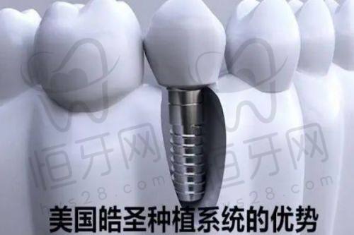 怡美永康口腔门诊部：进口种植体全线覆盖，适合重视品牌质量用户