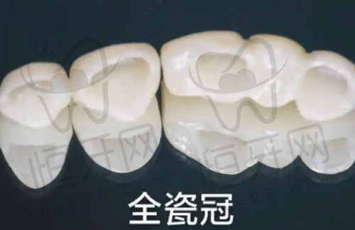 绵阳恒齿口腔:擅长复杂病例,适合口腔状况差的人