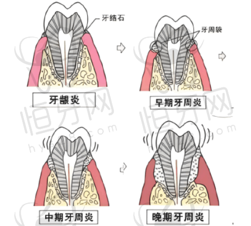 太原华美口腔医生名单：