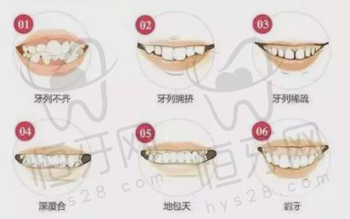 莆田群益口腔:种植+正畸综合实力强