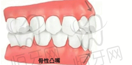 揭阳口腔医院哪个好？大型连锁牙博士与华美口腔，种植牙技术大比拼！