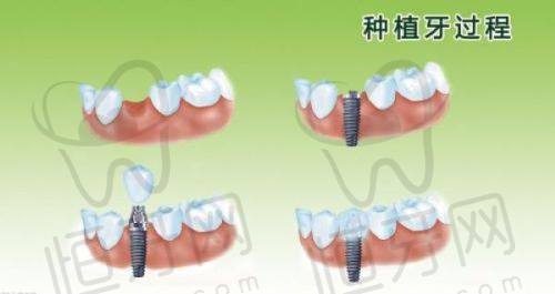 新乡口腔医院排名前十一览表