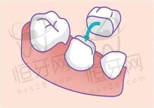 淮腔医院：医生团队稳定、数字化矫正更快更准