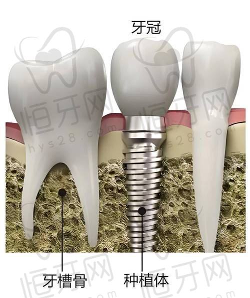湛江牙加美口腔：儿童牙科、显微根管技术优势突出