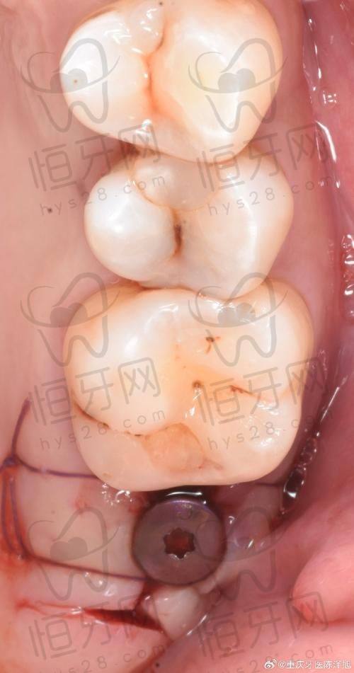湛江口腔医院哪家最好？柏乐、致美、牙加美优势大揭秘，别错过！