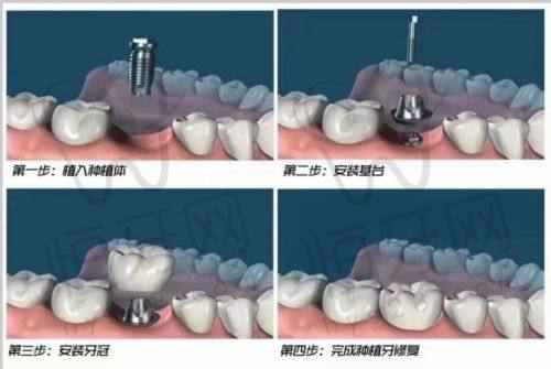 粤北口腔：品牌老品牌，医资技术稳定