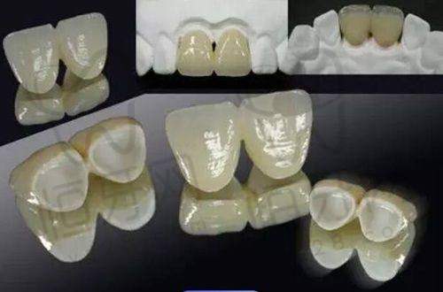 呼和浩特优洁口腔门诊部口碑怎么样？