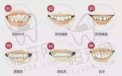 呼和浩特天牙口腔门诊部怎么预约挂号？