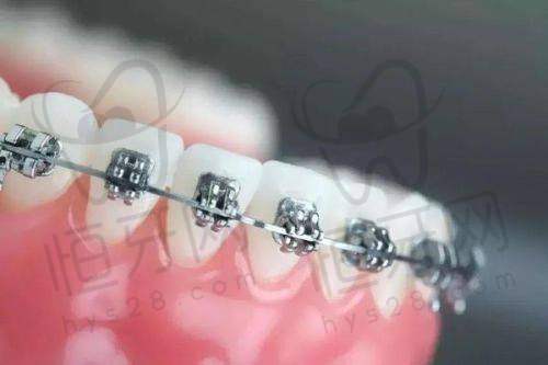 潮州天伦口腔：专注拔牙、种植、儿童齿科