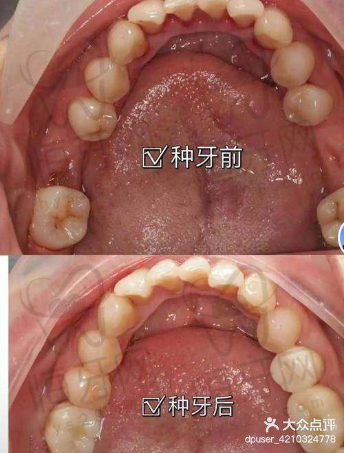 哪家适合你？按人群推荐