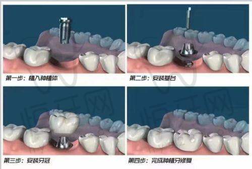 呼和浩特万诺口腔门诊部特色优势：