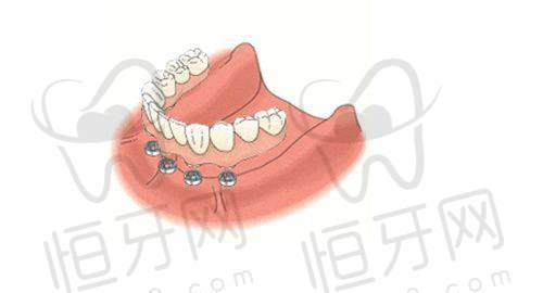 宿迁安诺口腔门诊部：全年无休看牙，适合上班族