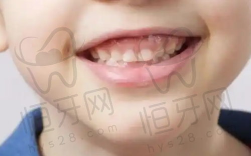 三明博悦口腔:项目全,医生多,适合多样牙齿问题