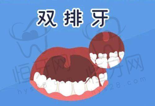 壹舟口腔：儿童牙科优选，软性环境好