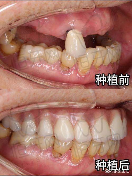 爱尔口腔韶关分院：多城市连锁，诊疗流程标准化