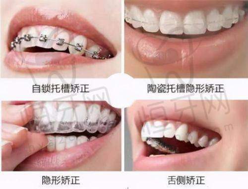 丽诺齿科：要“好看”的来这里