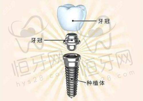 尹兆康牙科诊所:老牌牙医坐镇美学修复好