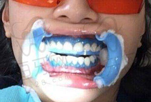 泰兴吾悦口腔门诊部擅长什么项目: