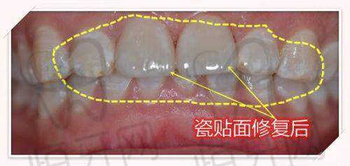 【阳泉刘俊口腔诊所患者口碑评价：】