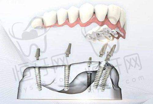 【阳泉刘俊口腔诊所怎么预约挂号?】