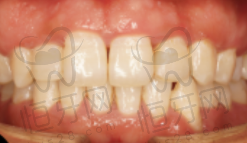 【温州泰顺牙贝恩口腔门诊部核心优势：】