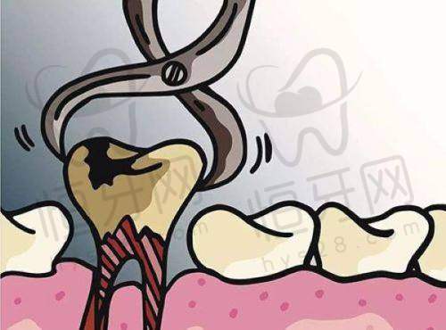 【慈溪博瓦口腔门诊部特色项目：】