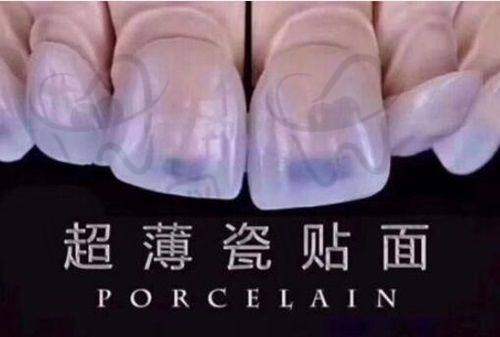 【嘉兴曙光口腔医院是正规的吗?】