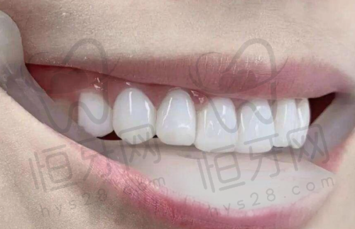 【芜湖德瓦口腔门诊部是正规的吗?】