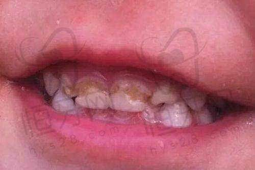 【合肥佳德口腔是正规的吗?】