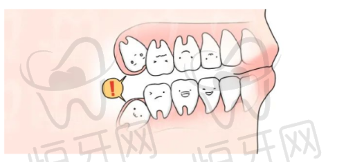 【福州登特口腔医院（台江分院）是正规的吗?】