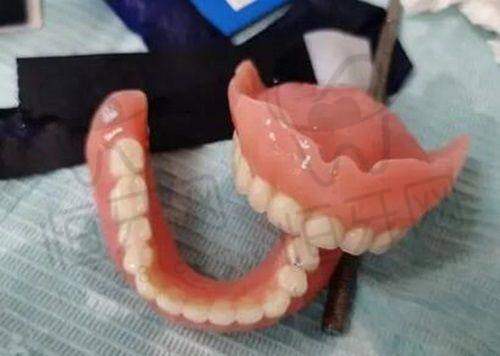 北京劲松口腔医院收费价格