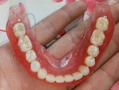 北京劲松口腔医院正规吗?资质、价格、口碑全解析