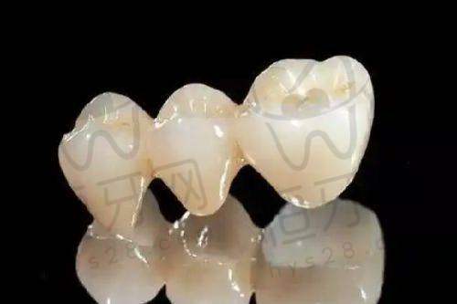 北京维乐口腔医院就诊体验报告