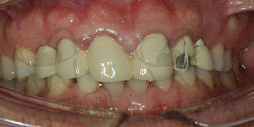 北京劲松口腔医院更擅长什么？牙齿矫正堪称