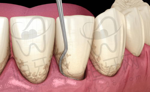 北京维乐口腔医院真实患者评价