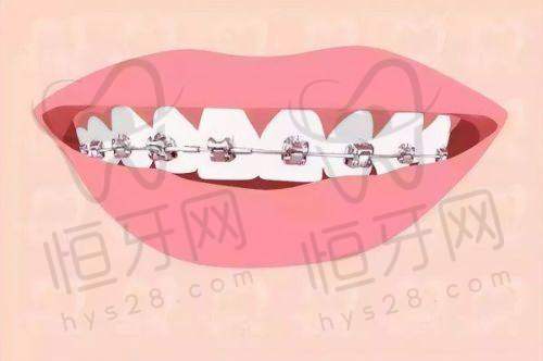 北京维乐口腔医院用户实测：过来人的血泪经验