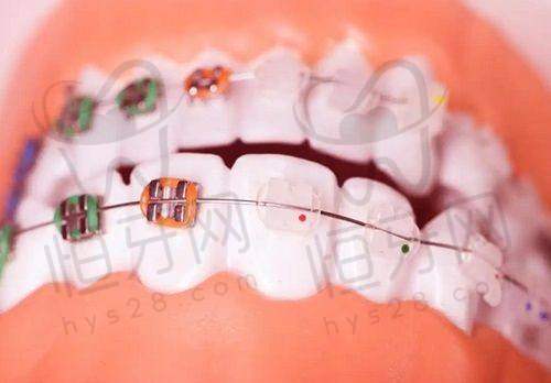 北京劲松口腔医院价格刺客还是良心价?