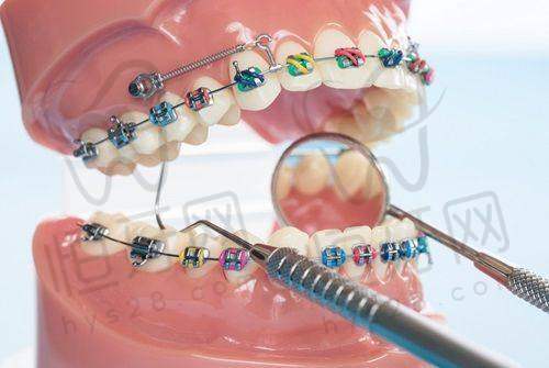 北京劲松口腔医院13家分院特色揭秘