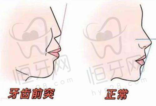 北京劲松口腔医院口碑是刷的还是真的?